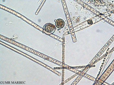 phyto/Scattered_Islands/all/COMMA April 2011/Oblea rotunda (ancien Taxon Oblea-Gotoius 2 > Obléa sp1)(copy)_thumb.jpg